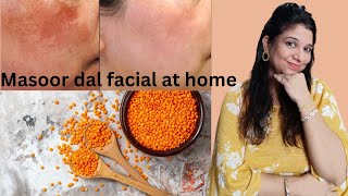 Masoor dal facial  Facial for pigmentation dark spots and tanning skin whitening facial [upl. by Weidar]