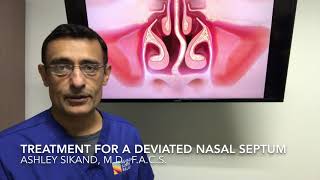 Treatment For A Deviated Nasal Septum [upl. by Kavanaugh104]