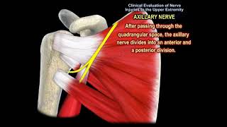 NERVE INJURY IN THE UPPER EXTREMITY Everything You Need To Know  Dr Nabil Ebraheim [upl. by Annatnas]