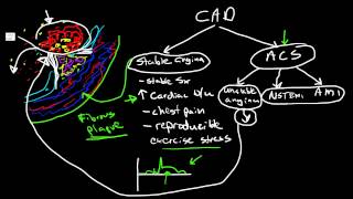 Pathophysiology of Coronary Artery Disease [upl. by Anaile]