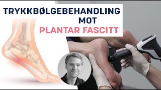 Effektiv Trykkbølgebehandling mot Plantar Fascitt [upl. by Fornof662]