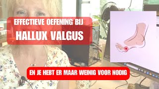 EFFECTIEVE OEFENING HALLUX VALGUS [upl. by Freed10]