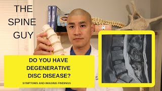 Lumbar Degenerative Disc Disease Part 1 Symptoms and Imaging [upl. by Marta]