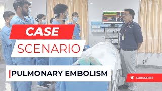 Case Scenario  Pulmonary Embolism [upl. by Derag]