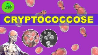 CRYPTOCOCCOSE  cours de mycologie médicale [upl. by Aietal]