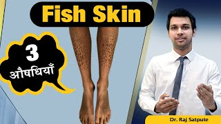 Fish Skin Disease 100 Cure in HINDI  Ichthyosis Vulgaris Permanent Cure by Jyovis Dr Raj Satpute [upl. by Eisele184]