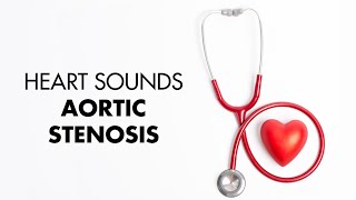 Intro to EKG Interpretation  EKG Leads [upl. by Adnalra]