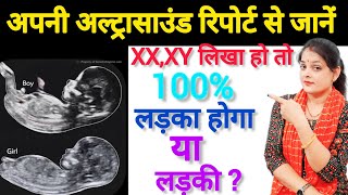 Altrasound रिपोर्ट में XY और XX लिखा तो लड़का होगा या लड़की How to Read Altrasound Report anomal [upl. by Noslrac948]