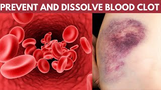 prevent and dissolve blood clot [upl. by Ecnerol]