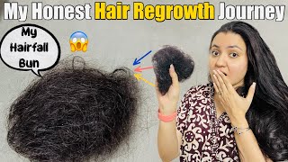 My Hair Loss amp Hair Regrowth Journey  Sharing My Story❤️ [upl. by Gonzalez]