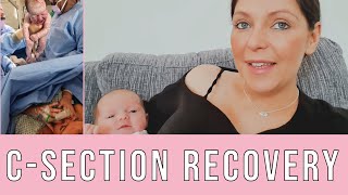 My Positive Elective CSection Birth Experience amp Recovery Story [upl. by Ciro129]