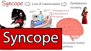 Syncope and Fainting Syncope Types and Treatment Simply explained [upl. by Hayashi]