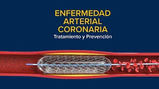 Enfermedad Arterial Coronaria EAC Tratamiento y prevención [upl. by Eelime]