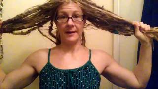 Head lice infestation [upl. by Lareena]