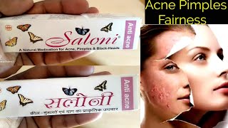 Saloni anti acne cream use or side effects in hindi [upl. by Eniad854]