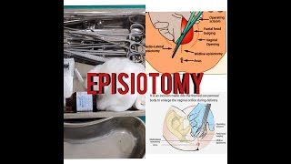 EPISIOTOMY EPISIOTOMY TRAYINSTRUMENTEASY EXPLANATIONSUSES [upl. by Renata]