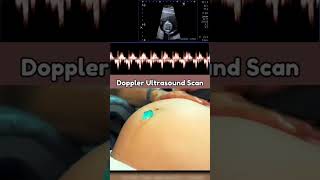 Doppler ultrasound pregnancy viral baby youtubeshorts [upl. by Onitrof111]