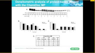 Reliable Quantification of Western Blot Data [upl. by Terris]