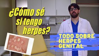 Herpes Genital ¿Tiene Cura  Dr Ego [upl. by Enitsuga]