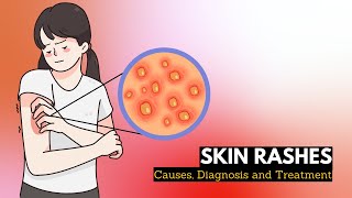 Skin Rash Causes Signs and Symptoms Diagnosis and Treatment [upl. by Llebasi]