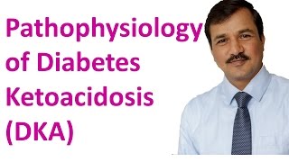 Diabetes Ketoacidosis DKA  Pathophysiology [upl. by Zaob]