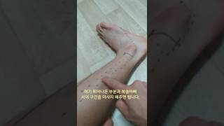 비골근 근막이완 Fibularis Longus Brevis SMR [upl. by Kolivas385]