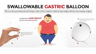 Swallowable Gastric Balloon Elipse Allurion Balloon Pill Side Effects Reviews Cost in India [upl. by Sadick954]