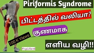 Piriformis Syndrome in TamilPiriformis Pain Relief Exercisesபிட்டத்தில் உள்ள வலிபோக எளிய வழி [upl. by Whatley]