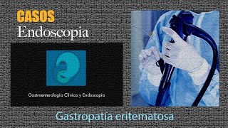 Gastropatía eritematosa [upl. by Eidnyl]