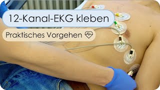 Anlage eines 12KanalEKG Skills EKG kleben EKGElektroden Reihenfolge EKGAuswertung [upl. by Kylila]