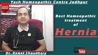 Best Homeopathic Treatment of Hernia  हर्निया का सबसे अच्छा उपचार  Yash Homeopathic Centre [upl. by Ardra445]