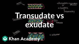 Transudate vs exudate  Respiratory system diseases  NCLEXRN  Khan Academy [upl. by Terina231]