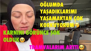 OĞLUMDA YAŞADIKLARIMI YAŞAMAKTAN ÇOK KORKUYORUM😢TRAVMALARIM ARTTI🥺KARNINI GÖRÜNCE ŞOK OLDUK🤲 [upl. by Hsatan]