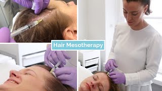 Hair Loss Mesotherapy  The Laser and Skin Clinic [upl. by Zumwalt676]