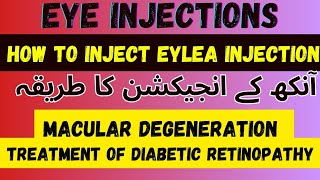 Intravitreal Eylea injection 💉  Intravitreal AntiVegf Injection  Dr Faisal Anwar [upl. by Aurore]