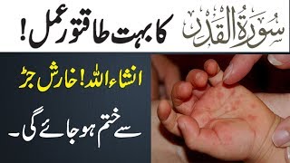 Scabies Ka Mukammal Ilaj  خارش کو 11 دن میں ختم کریں [upl. by Yenhoj]