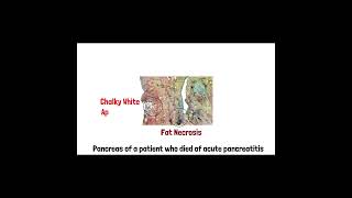 Cell Injury Pathology  Reversible and Irreversible Cell Injury  Part 2 doctor mbbs anatomy [upl. by Niu]