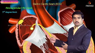 Cardiac output Quick review  CVS Physiology USMLE Step 1 [upl. by Retsam]