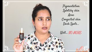 SESDERMA AZELAC RU Liposomal Serum TRX Review  Hindi [upl. by Eirrehs]