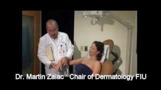 Vitiligo Laser treatment XTRAC Miami By Martin Zaiac MD Lasers for Vitiligo [upl. by Garcia]