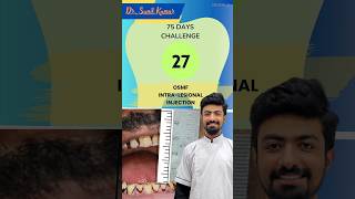 2775 Days Challenge 75dayshardchallenge dentist singledaydentistry dentalclinic [upl. by Nohs175]