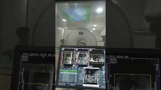 mrcp scan mriradiologycareer viralshort bscradiology trendingshorts trendingshorts gb gbstone [upl. by Anabella]