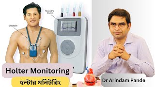 হল্টার মনিটরিং I Holter Monitoring Different types When needed What it detects  Dr Arindam Pande [upl. by Atinhoj]