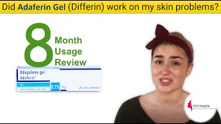 Adaferin Gel Differin 8 Months Use Review [upl. by Field]