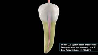 Finishing criteria with WaveOne® Gold and Dr Ruddle  Dentsply Sirona [upl. by Yahsed298]