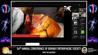 OrthoTV  Orthopaedic Surgery amp Rehabilitation Video amp Webinars  Dr Parag Sancheti [upl. by Hinson]