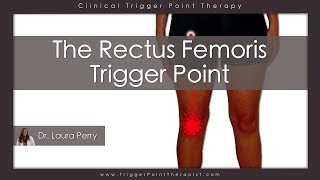 The Rectus Femoris Trigger Point [upl. by Gentes]