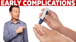 The First Complication of Diabetes – Dr Berg on Prediabetes Symptoms [upl. by Nimrac]