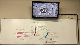 Tecido Ósseo [upl. by Nrubua292]