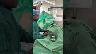 देखिए कैसे होता है वैरिकोसेल का इलाज  Live Varicocele Embolization shortsfeed2024 livesurgeryroom [upl. by Suiramed715]